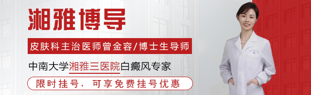 岳阳到哪看白癜风